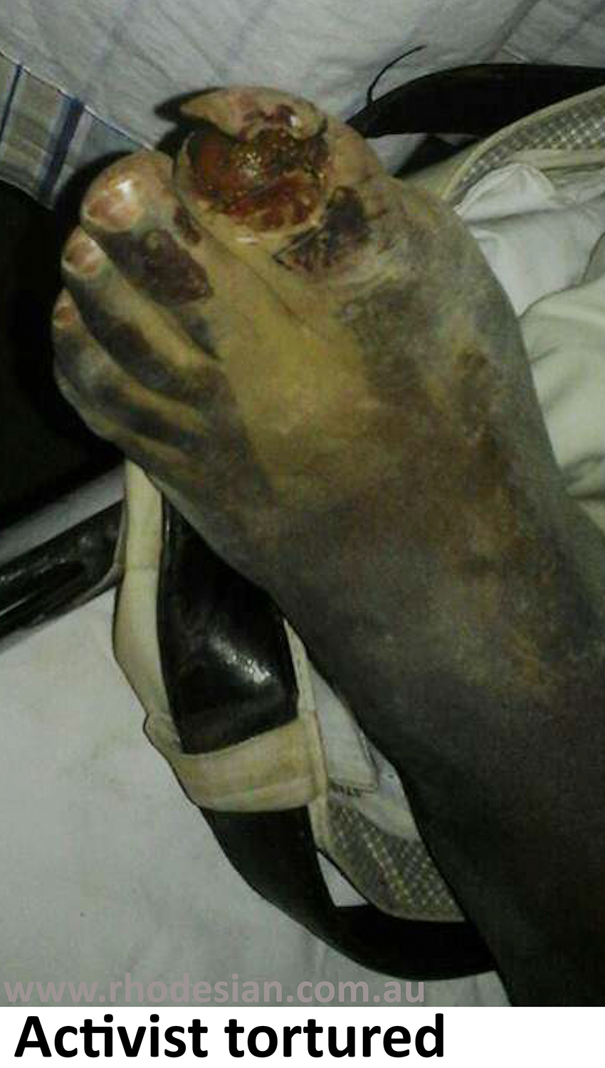 Zimbabwe activist Sylvanos Mudzvova was abducted but relased after torture and removal of big toe nail